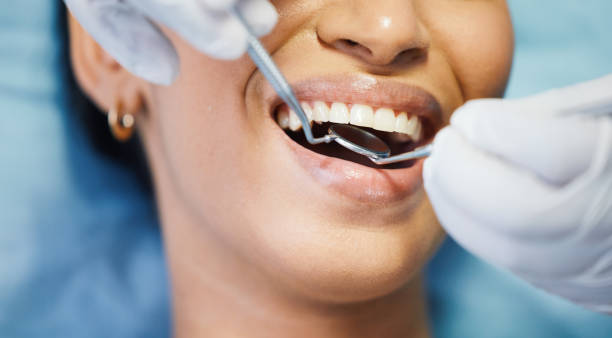 Best Urgent Tooth Repair  in Four Bridges, OH
