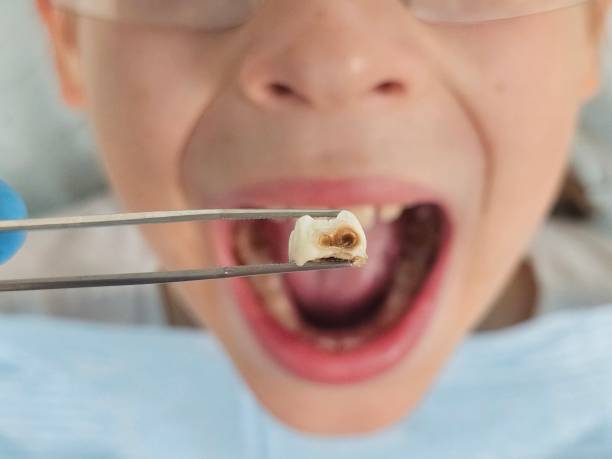 Best Tooth Pain Emergency Relief  in Four Bridges, OH